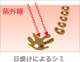 紫外線 日焼けによるシミ