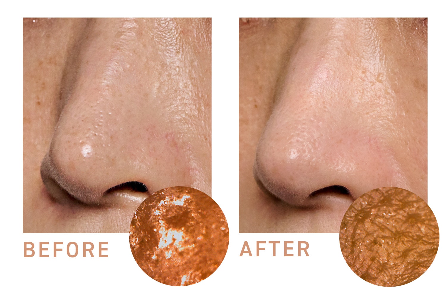 40代社員毛穴ビフォーアフター