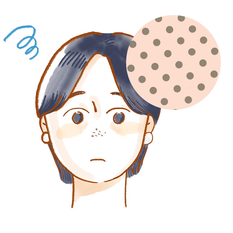 黒ずみ毛穴