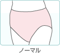ノーマル