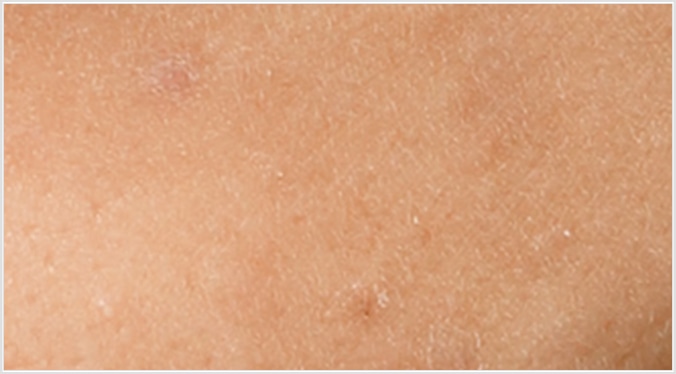 乾燥肌・ごわつき肌