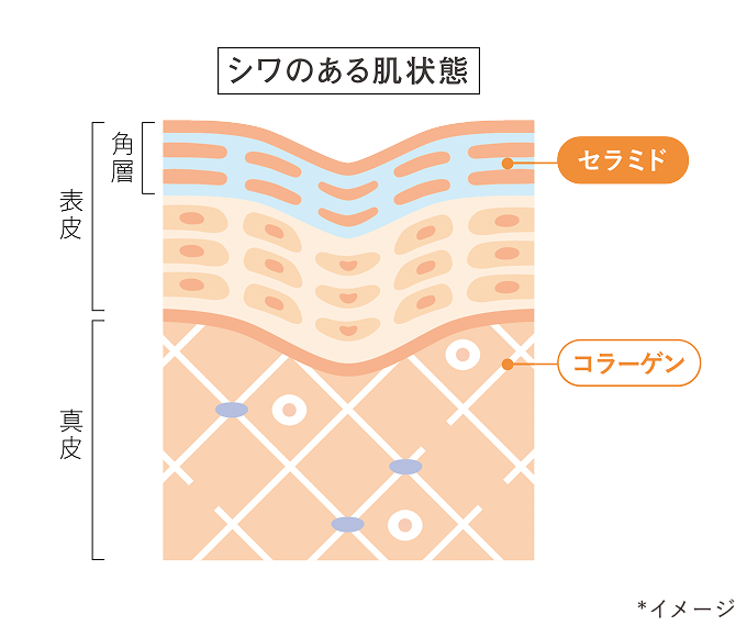 （肌図）*イメージ