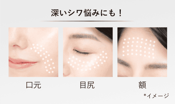 深いシワ悩みにも！ 口元 目尻 額 *イメージ