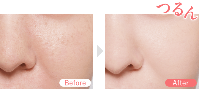 「つるん」ポアレスキーププライマーのBefore After 使用イメージ
