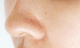 毛穴が目立つ肌の写真