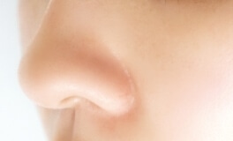 毛穴が目立たない肌の写真