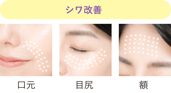 口元 目尻 額 シワ改善イメージ