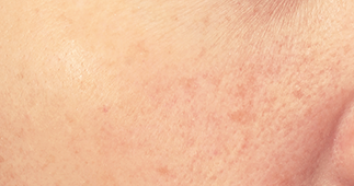 リンクルホワイトエッセンス 化粧品 スキンケア 基礎化粧品の通販 オルビス公式オンラインショップ