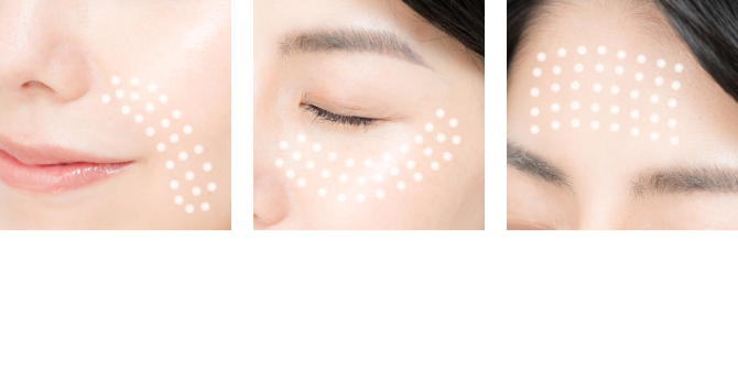口元 目尻 額 *イメージ