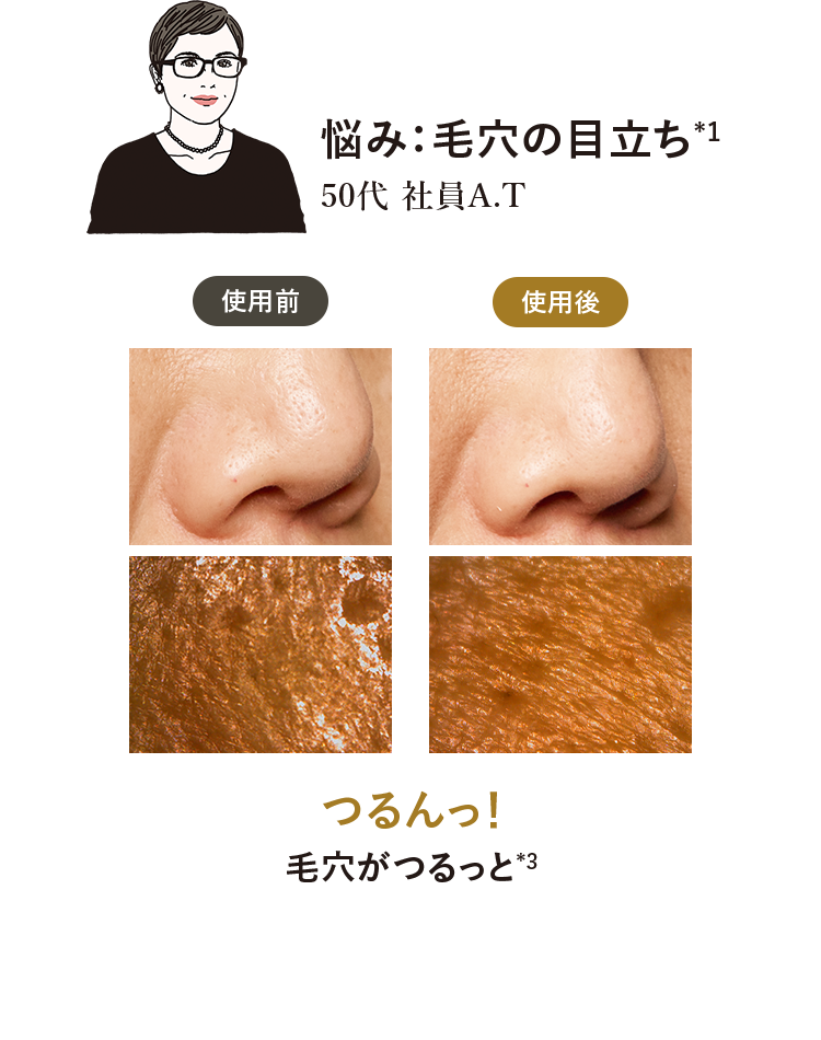 slide1 悩み：毛穴の目立ち*1 つるんっ！毛穴がつるっと*3
