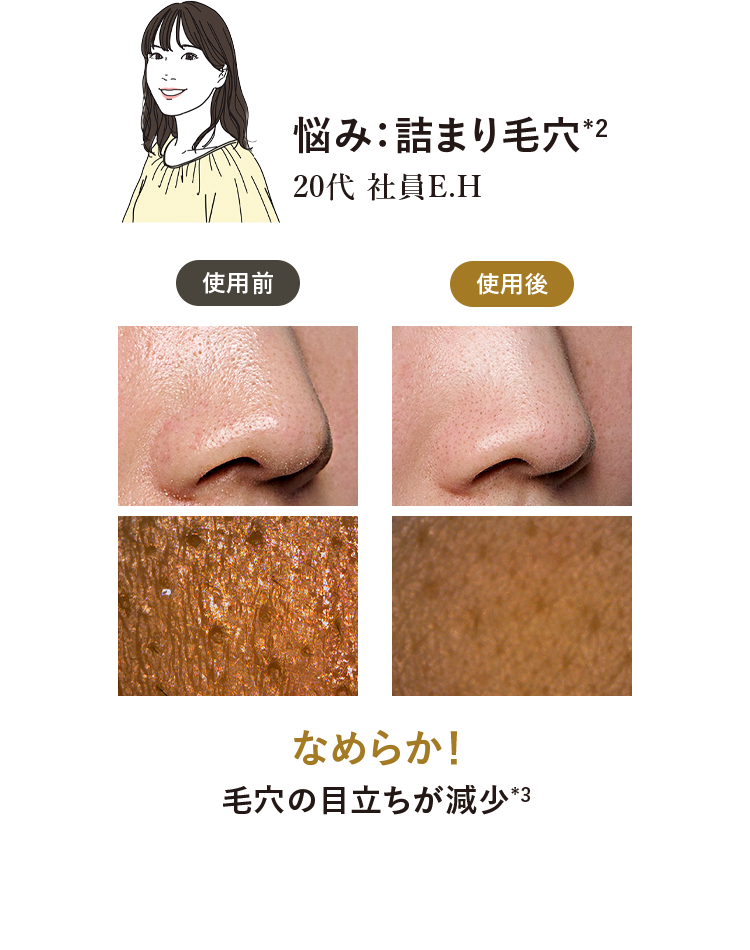 slide3 悩み：詰まり毛穴*2 なめらか！毛穴の目立ちが減少*3