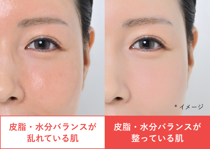 （比較）皮脂・水分バランスが乱れている肌／皮脂・水分バランスが整っている肌 *イメージ