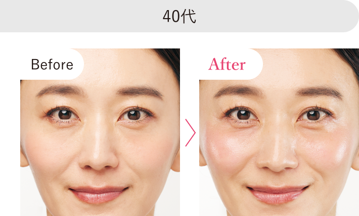 40代 Before After 比較