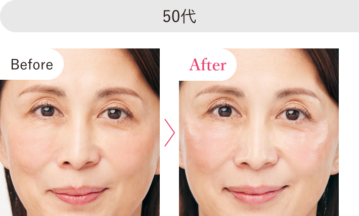 50代 Before After 比較