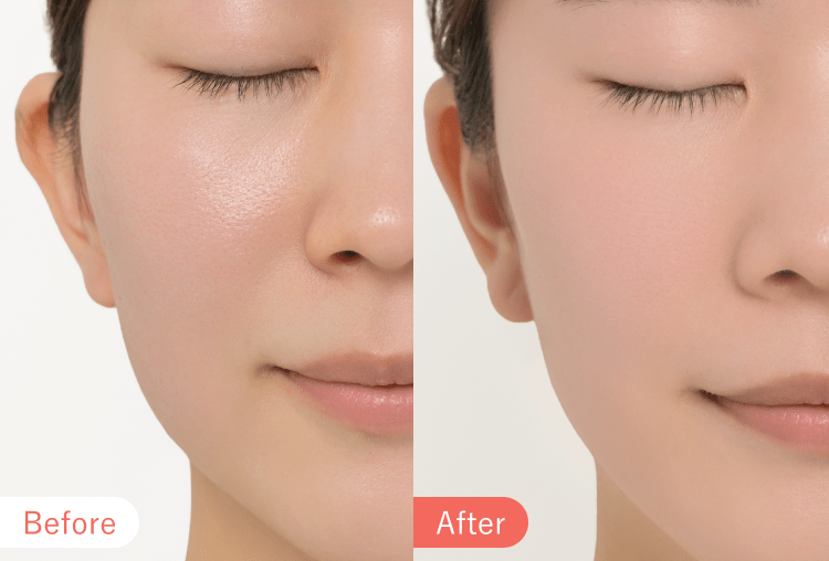 Before After