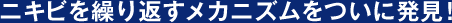 ニキビを繰り返すメカニズムをついに発見！