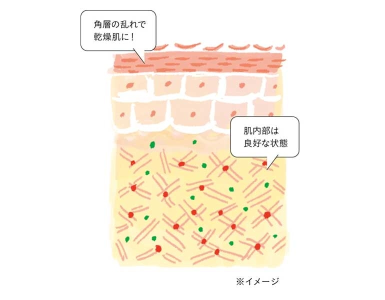 年代別の肌トラブルとその原因 年代別肌悩み ケア方法 徹底ガイド ２ 読み物 日々をここちよく 化粧品 スキンケア 基礎化粧品の通販 オルビス公式オンラインショップ