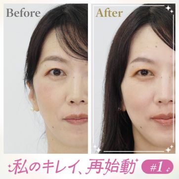 40代の私にちょうどいい。目元悩みに応える変身メイク｜私のキレイ、再始動 #1