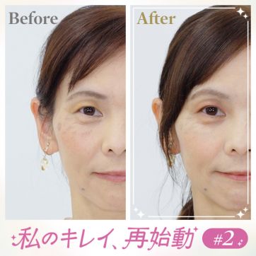 シミを隠したくてつい厚塗りに。重ねず魅せる「目線外しテク」で、大人の上品ツヤ肌｜私のキレイ、再始動 #2