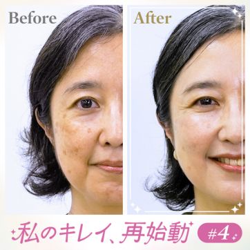 「お母さん、シミがなければ…」娘のひと言がきっかけ。ノーメイク派の私がナチュラルメイクを学びます｜私のキレイ、再始動 ＃4