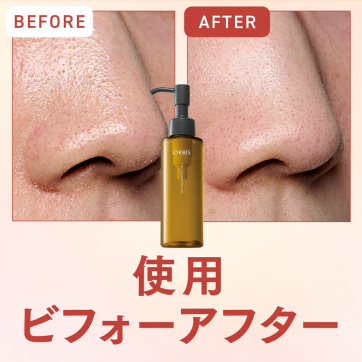毛穴汚れ撃退チャレンジ！ザ クレンジングオイルの使用ビフォーアフター